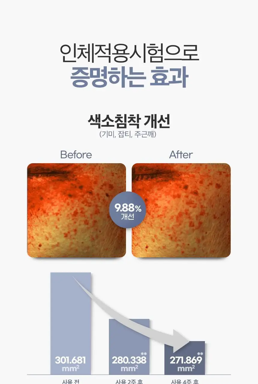[잡티케어] 디마르3 에트셀 멜라케어 크렘 65ml 상세페이지 15